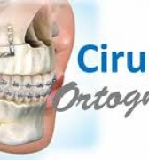 Cirurgia ortognática proporciona melhor qualidade de vida.